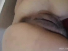 Cirugía en la cabeza del pene con puntadas que le dan a un novio chupar